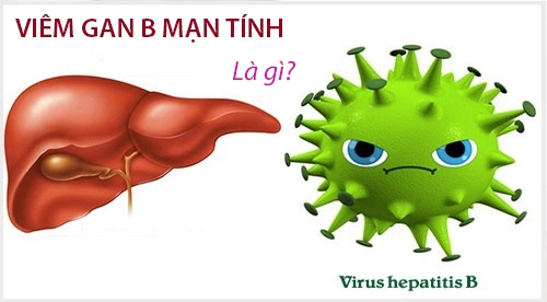 Viêm gan B mạn tính là gì? Phác đồ điều trị mới nhất hiện nay